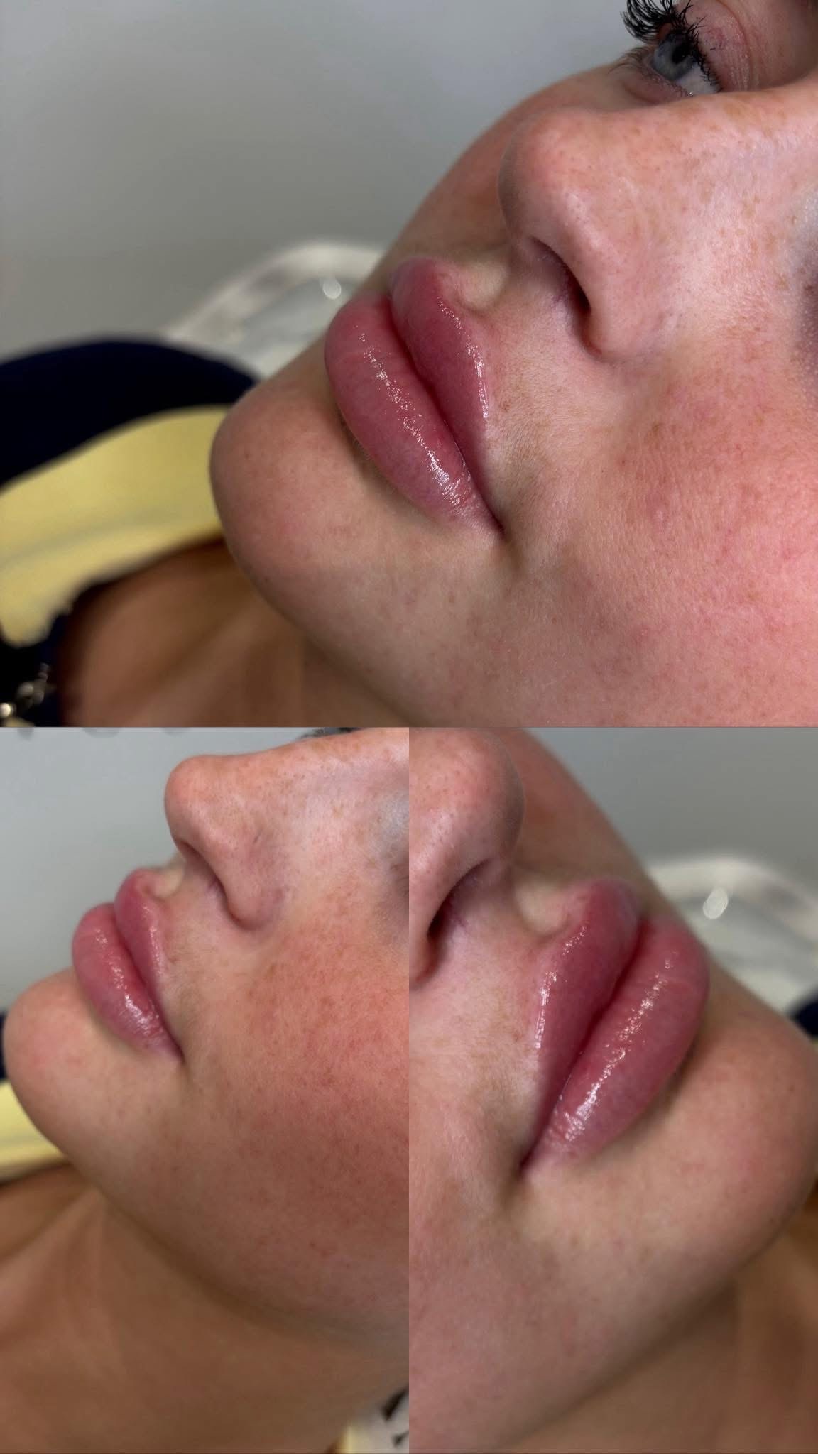 Before and after results