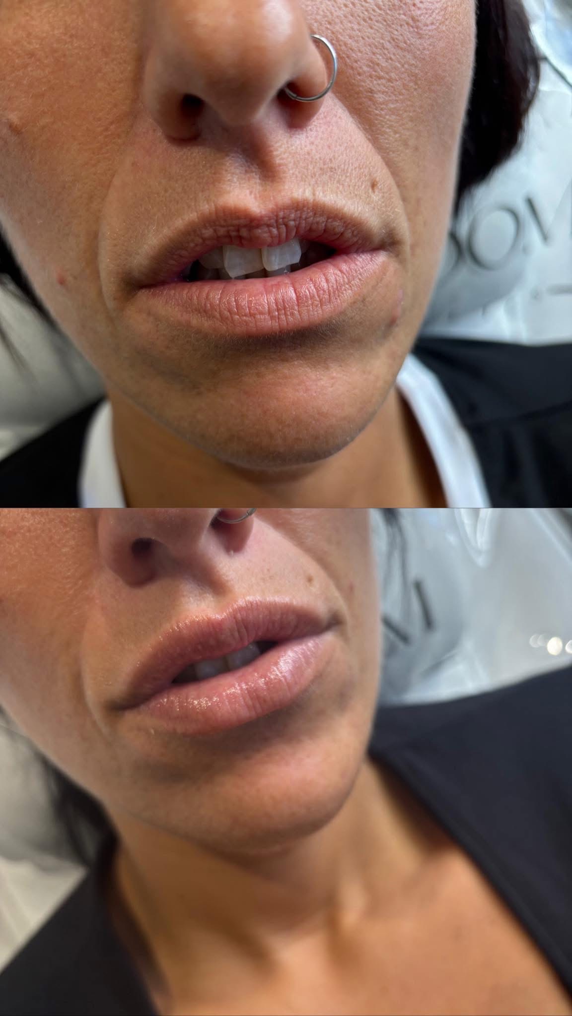 Before and after results