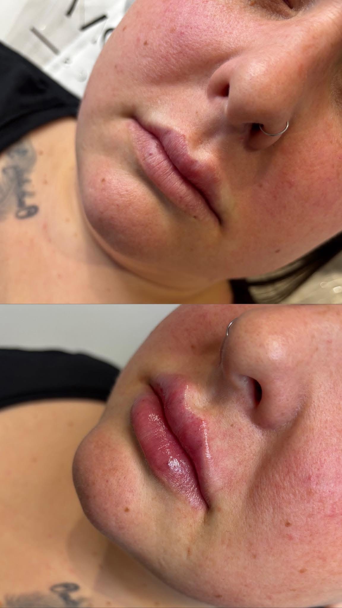 Before and after results