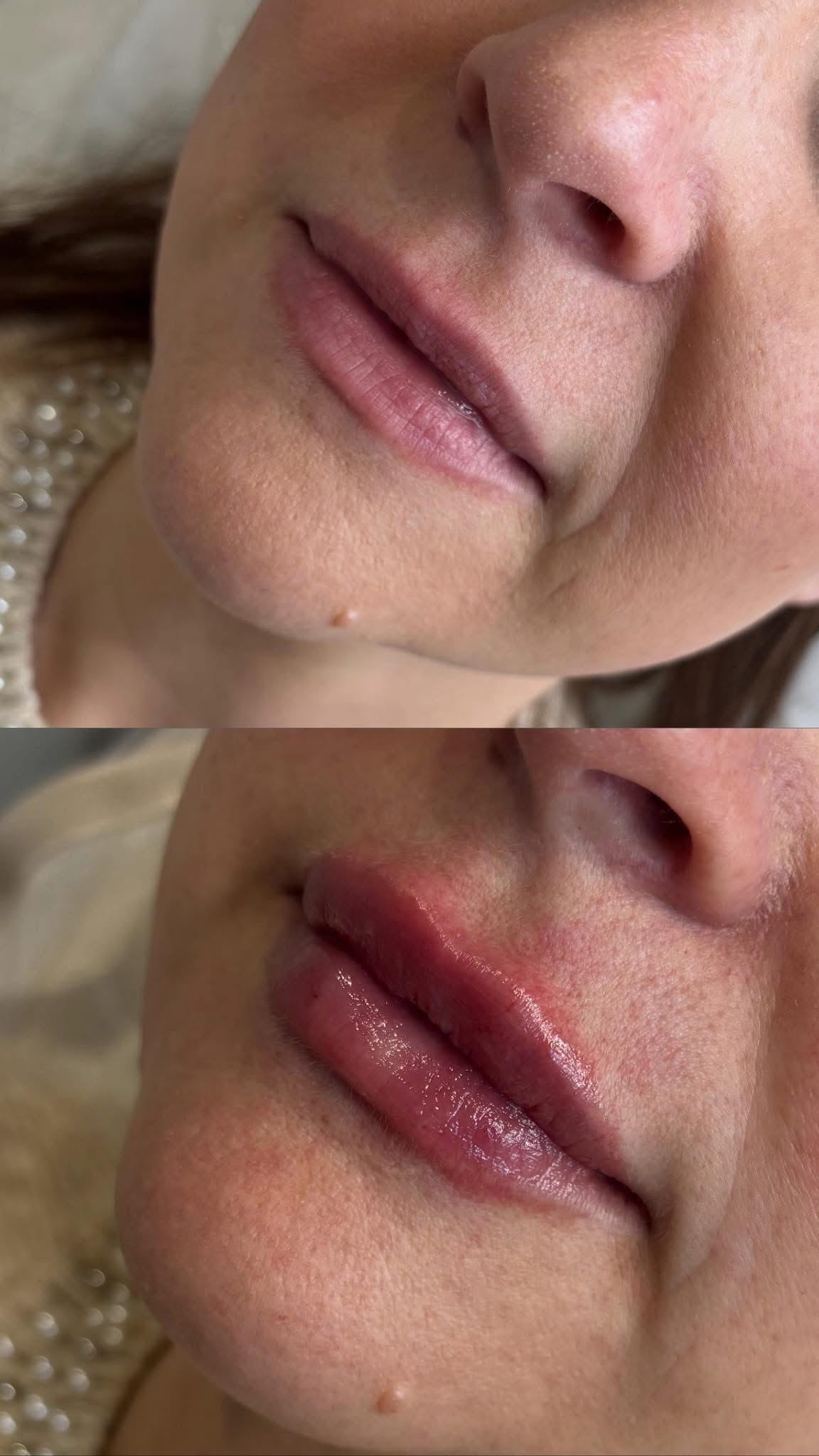 Before and after results