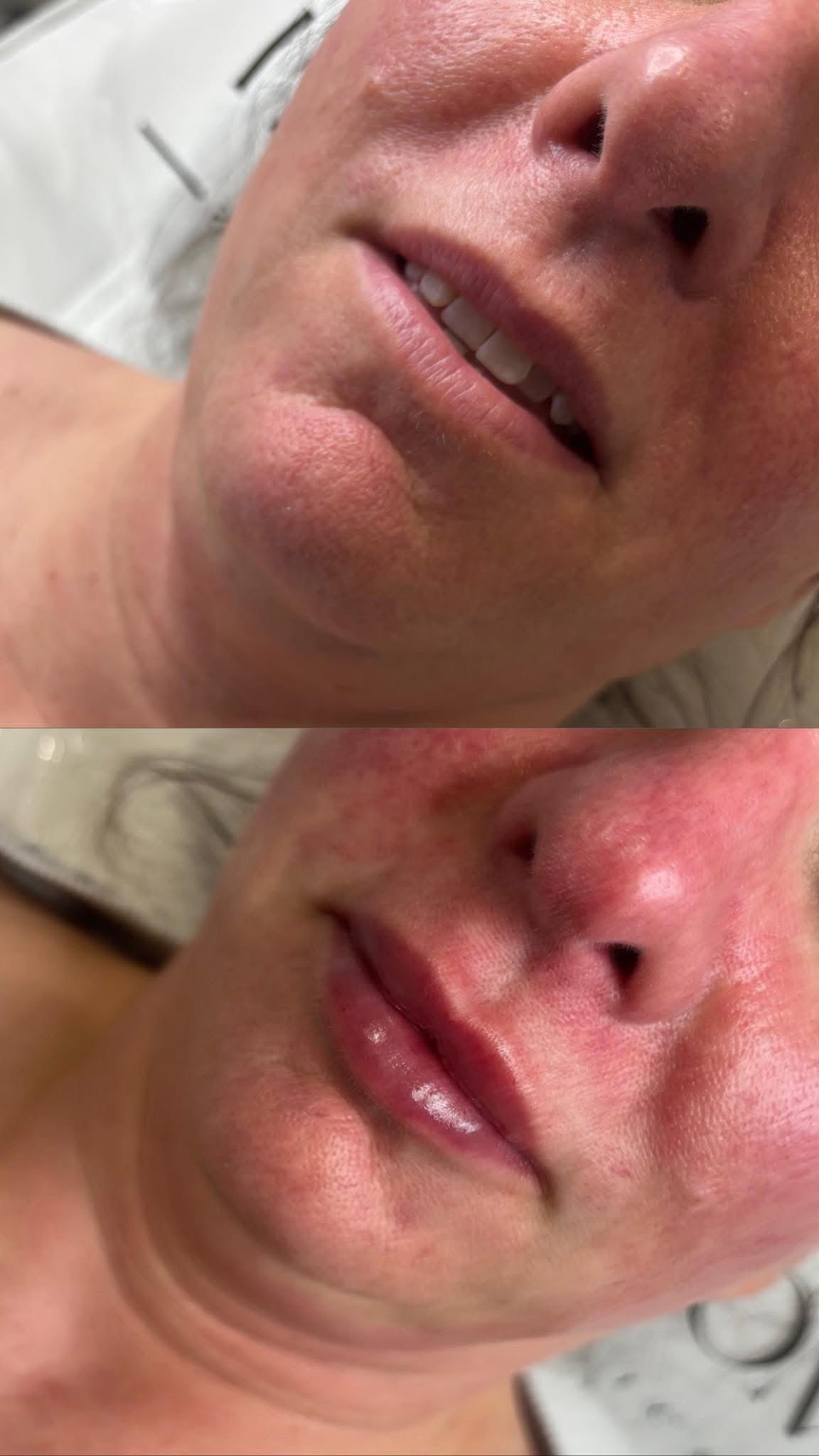 Before and after results